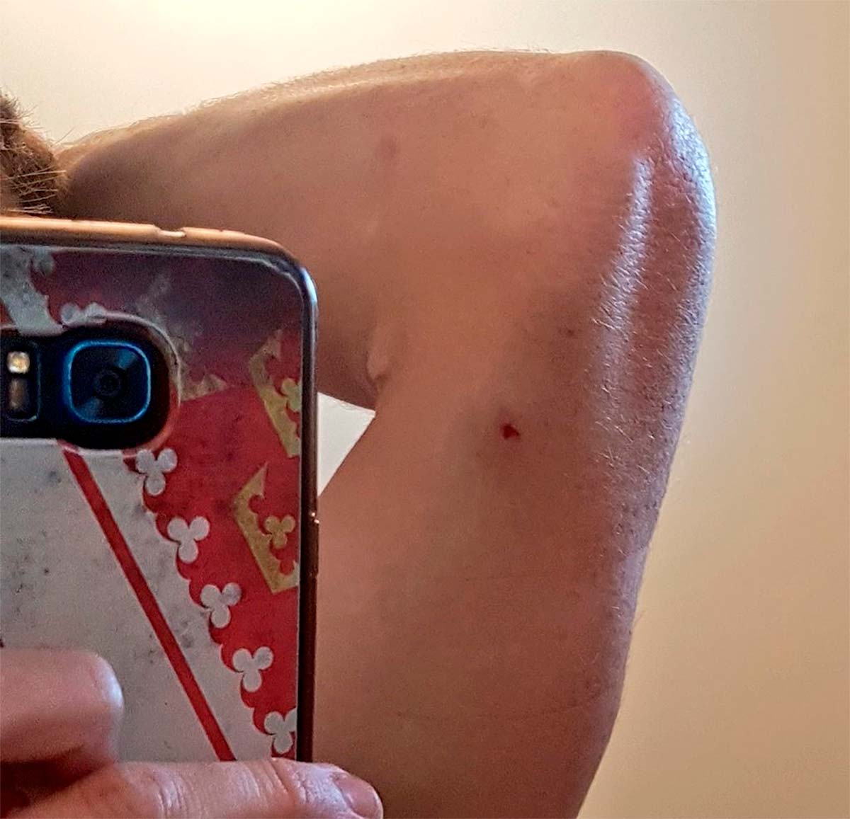 Maxime Marotte denuncia que ha sido tiroteado desde un coche mientras entrenaba