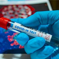 Practicar deporte después de haber padecido Covid-19 podría ser muy peligroso, según varios estudios