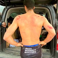Ángel Suárez se rompe 6 costillas mientras probaba bicicletas de Commencal