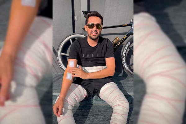 Alberto Contador pasa por quirófano para quitarse más de 100 lipomas de grasa