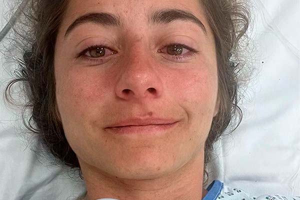 Isabeau Courdurier termina con un pie perforado por una rama en las EWS-E de Valberg