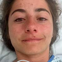 Isabeau Courdurier termina con un pie perforado por una rama en las EWS-E de Valberg