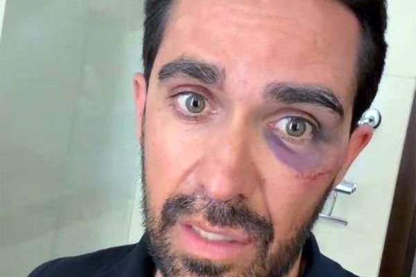 Alberto Contador sufre una caída en el Desafío China by La Vuelta y termina con puntos de sutura en ceja, pómulo y labio