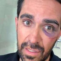 Alberto Contador sufre una caída en el Desafío China by La Vuelta y termina con puntos de sutura en ceja, pómulo y labio