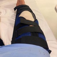 Jared Graves, con fractura de rótula y pie tras ser atropellado por un coche