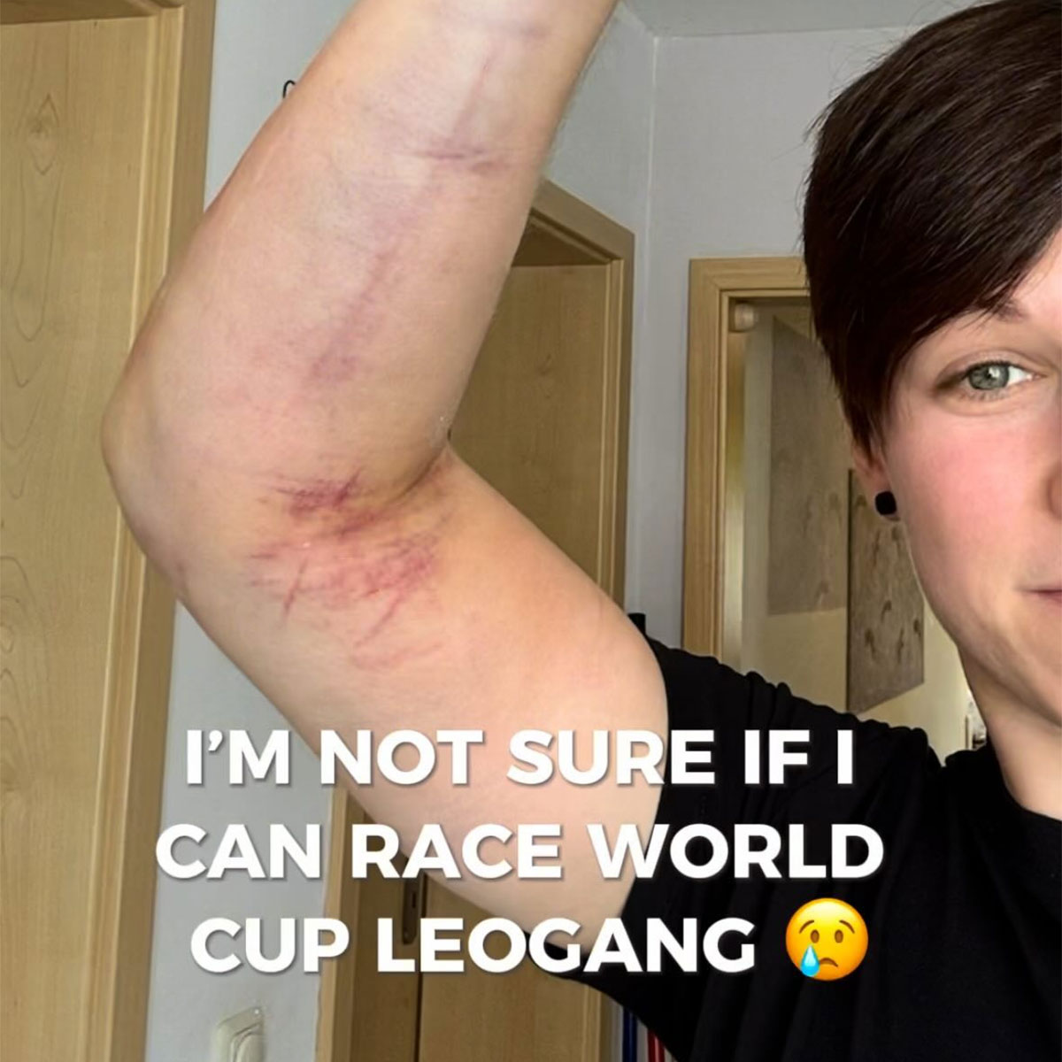 Nina Hoffmann podría perderse la tercera ronda de la Copa del Mundo de Descenso: un codo dislocado tiene la culpa